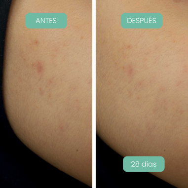 Piel con manchas visiblemente reducidas después de usar Crema noche antimanchas Alga-Biotic Laboratoires de Biarritz