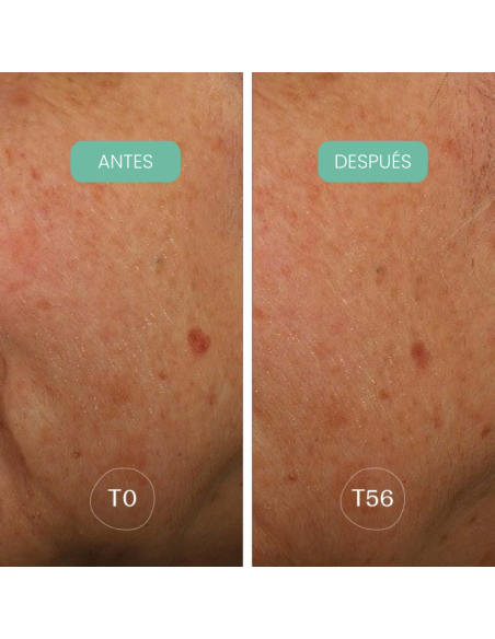 Piel con manchas visiblemente reducidas después de usar Crema noche antimanchas Alga-Biotic Laboratoires de Biarritz