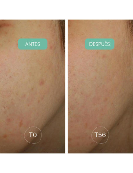 Piel con manchas visiblemente reducidas después de usar Crema noche antimanchas Alga-Biotic Laboratoires de Biarritz