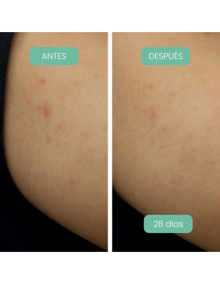 Piel con manchas visiblemente reducidas después de usar Sérum Facial antimanchas Alga-Biotic Laboratoires de Biarritz