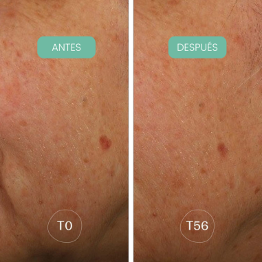 Sèrum facial antitaques Alga-Biotic...